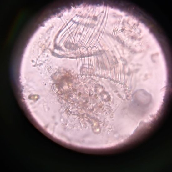 Craspedacusta-Nazop-L-01-04