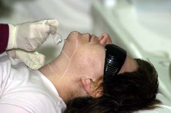 Fotodepilación: aplicación de gel conductor