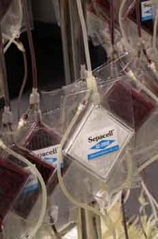 Filtro de leucocitos