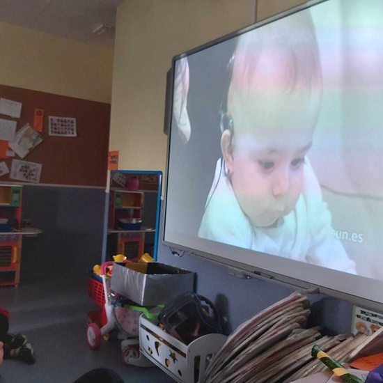 25F_dia_coclear (21)