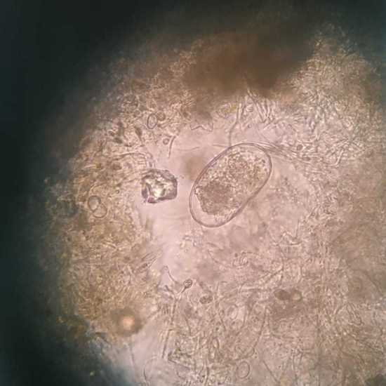 Ciliado-NazOpo-L-01-03-DA