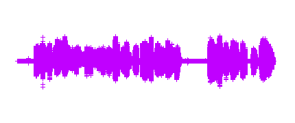 Radio 2ºB IES Santa Teresa de Jesús. Grupo 4