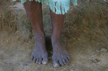 Pies de una vecina de Quilombo, Sao Paulo, Brasil
