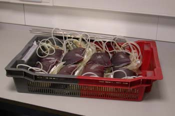 Bolsas de plasma sanguíneo