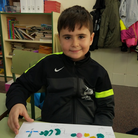 Día Internacional del Implante Coclear - ¿Cómo funciona un implante? 25