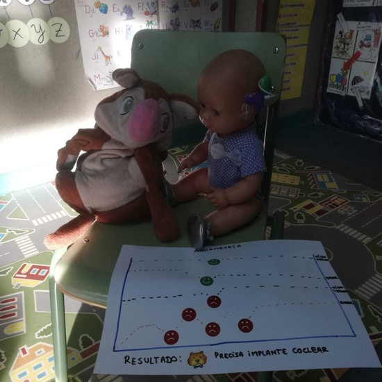 25F_dia_coclear (23)