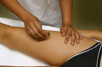 Vendas frías: aplicación de la ampolla reafirmante