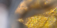 Día 15 - Microorganismos (foto de microscopio)