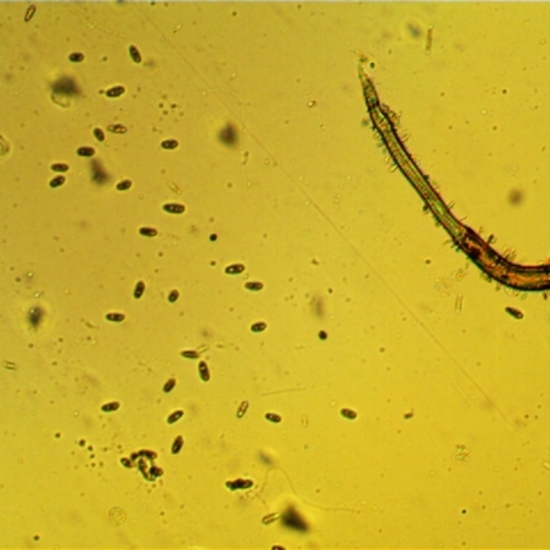 Anélido Oligoqueto ¿? hay que consultarlo L-01-04