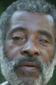 Hombre con catarata en los ojos, Quilombo, Sao Paulo, Brasil