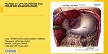 Hígado. Procesos degenerativos 