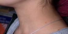 Cuello