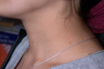 Cuello