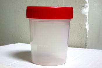 Recipiente de cultivos