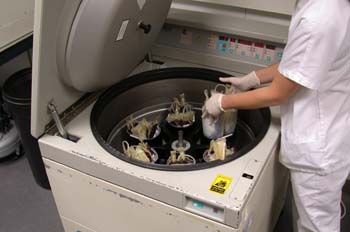 Centrifugado (de la sangre)