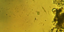 Cosmarium /Diatomeas L-01-04