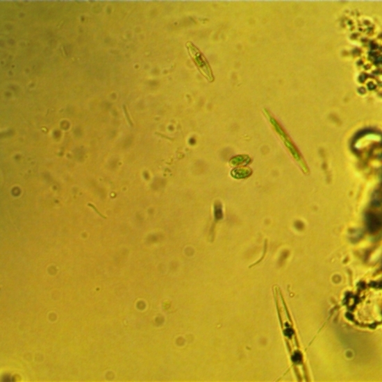 Cosmarium /Diatomeas L-01-04