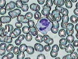 Práctica de Frotis sanguíneo 2