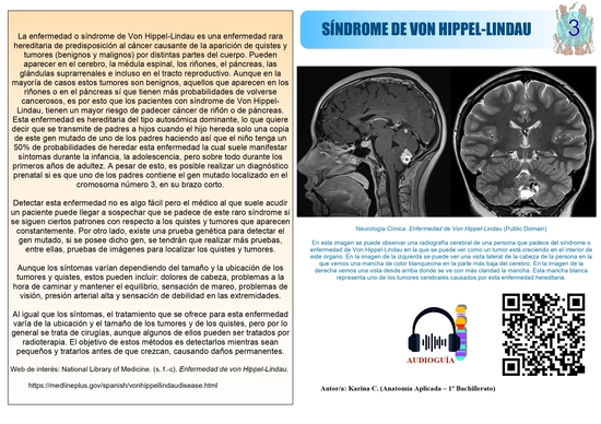 Póster síndrome de Von Hippel-Lindau