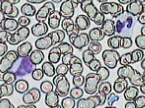Práctica de Frotis sanguíneo 32