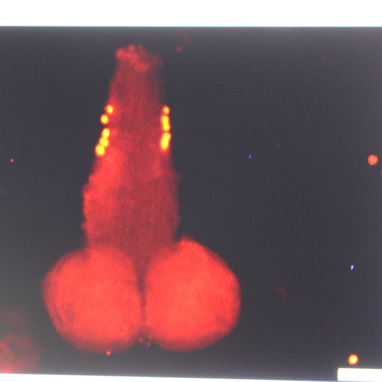 Imagen de microscopio de fluorescencia de ganglio cerebroideo de larva de Drosophila