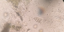 Vorticella_similis-Nazop-L-01-03-IG