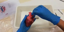 Heart dissection Walk Through