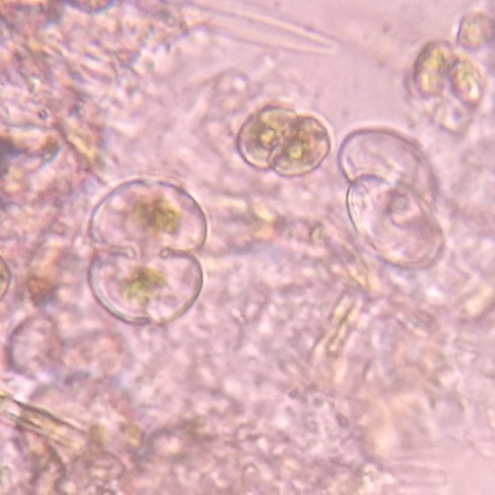 Cosmarium_Humile-Nazop-L-01-01