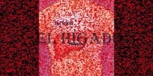 El hígado