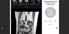 Anatomía básica para planificar estudio de rodilla MRI