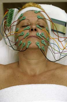 Electrolifting: finalización de la colocación de electrodos