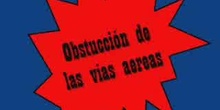 Obstrucción de la vía aérea