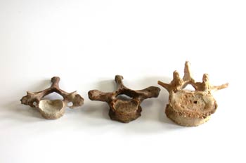 Vértebra cervical, torácica y lumbar