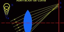 Aberración de Coma