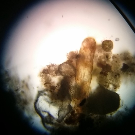 Larva de Dípterio 2