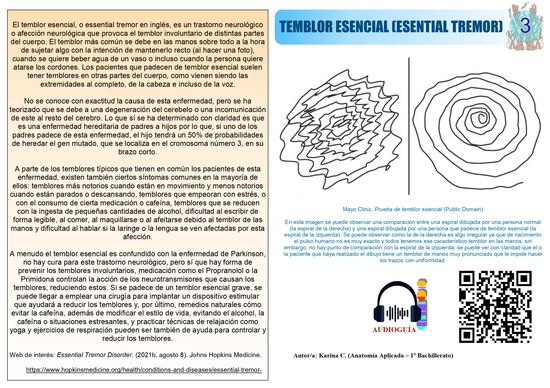Póster temblor esencial