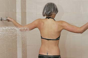 Chorros a presión: posición espalda extremidad superior izquierd