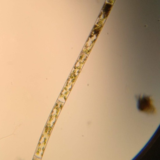spirogyra