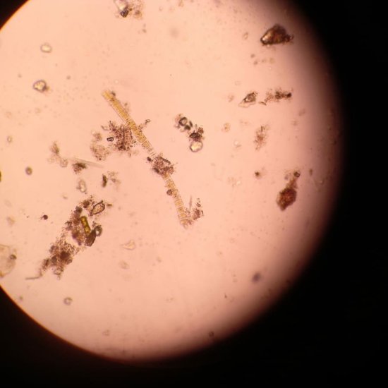 Oscillatoria_Lacustris-Nazop-L-01-04