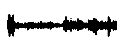 Anécdotas 3ºB grupo I