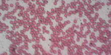 Células sanguíneas 5