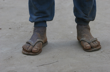 Pies de un vecino de Quilombo, Sao Paulo, Brasil
