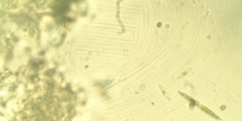 Diatomea 