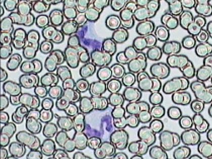 Práctica de Frotis sanguíneo 28