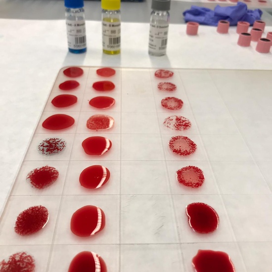 VISITA CENTRO DE TRANSFUSIÓN DE SANGRE 10