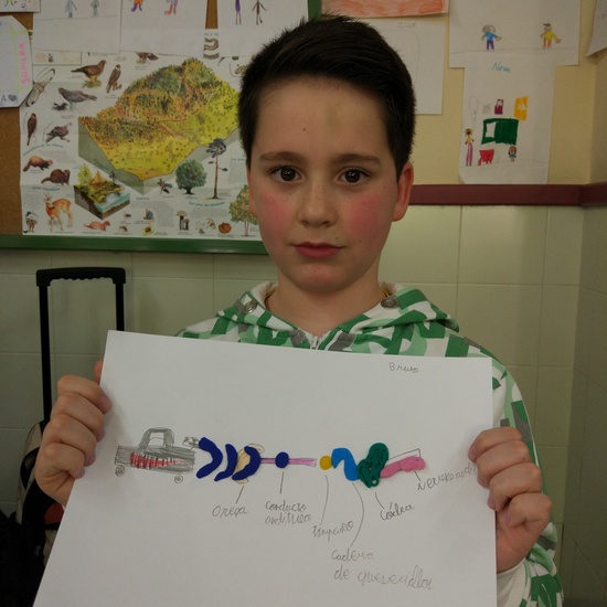 Día Internacional del Implante Coclear - ¿Cómo funciona un implante? 16