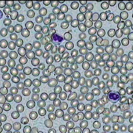 Práctica de Frotis sanguíneo 3