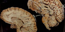 Sección del  cerebro