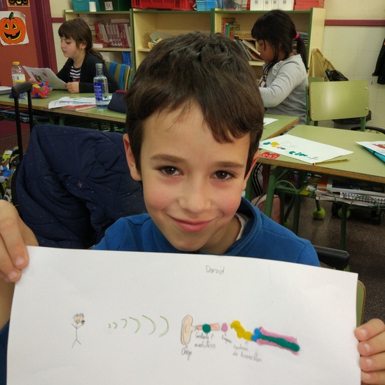 Día Internacional del Implante Coclear - ¿Cómo funciona un implante? 9