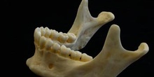 Mandíbula